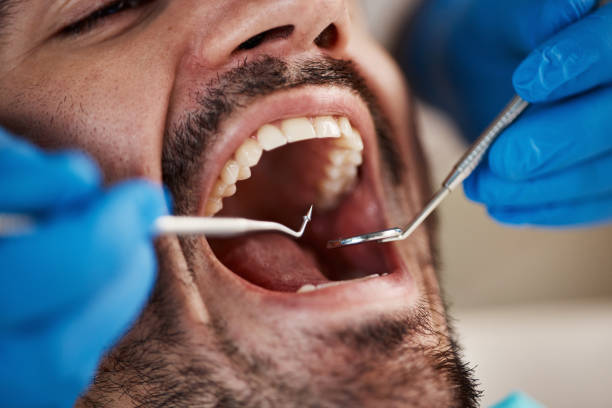 Best Emergency Dental Services for Seniors in Palo Cedro, CA